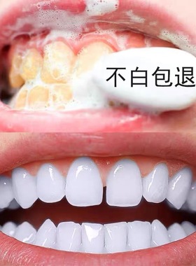 屈臣氏爆火~牙渍一擦即除~黑色烟渍~茶渍~去牙菌斑咖啡渍牙齿变白