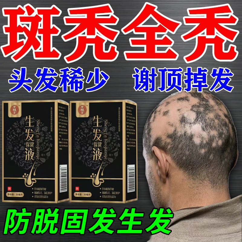 洗发水脂溢性脱发控油专用治疗男女士鬼剃头斑秃生发液头皮屑掉发