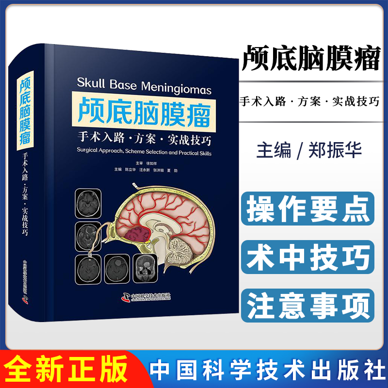 颅底脑膜瘤 手术入路·方案·实战技巧 9787523612453