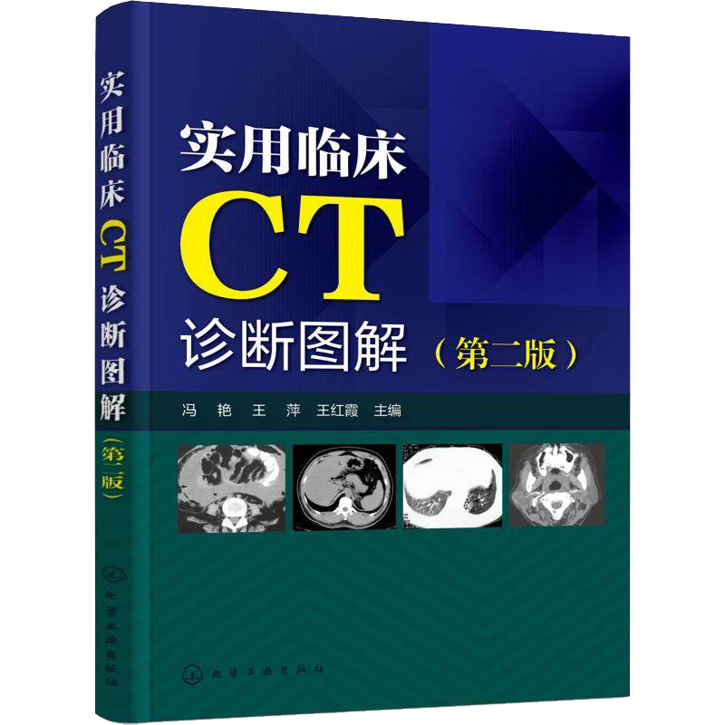 实用临床CT诊断图解 第二版 影像诊断、鉴别诊断和特别提示 典型CT影像图片 临床医学影像学CT读片诊断用书 冯艳主编 化学工业出版