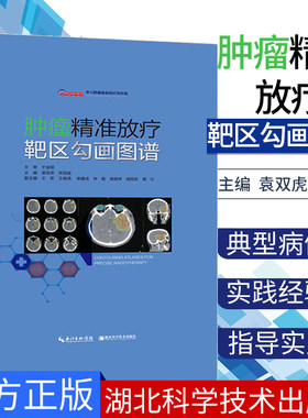 现货肿瘤精准放疗靶区勾画图谱
