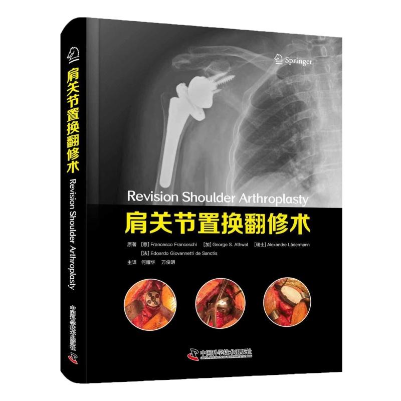 肩关节置换翻修术9787523616444中国科学技术出版社