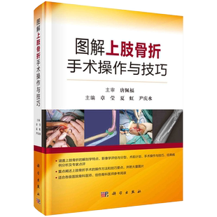 图解上肢骨折手术操作与技巧 章莹 夏虹 尹庆水 主编 锁骨骨折与肩锁关节脱位 手术操作与技巧 科学出版社 9787030712721