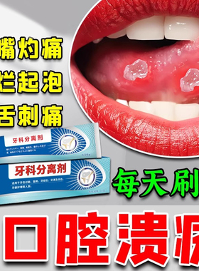 口腔溃疡专用牙膏口舌生疮上火起泡牙龈出血肿疼痛牙周炎专业牙膏