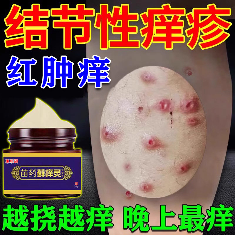 结节性痒疹特治顽效固硬疙瘩胳膊小腿上湿疹丘疹瘙痒红肿止痒膏药