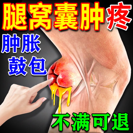 北京同仁堂腘窝囊肿贴膝盖腿后窝筋疼专用膏药贴关节鼓包肿胀疼痛
