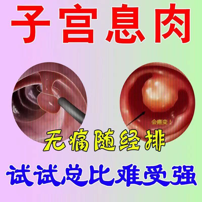 子宫内膜息肉药内膜太厚中药调理宫颈纳囊肥大下垂专用去除宫舒贴