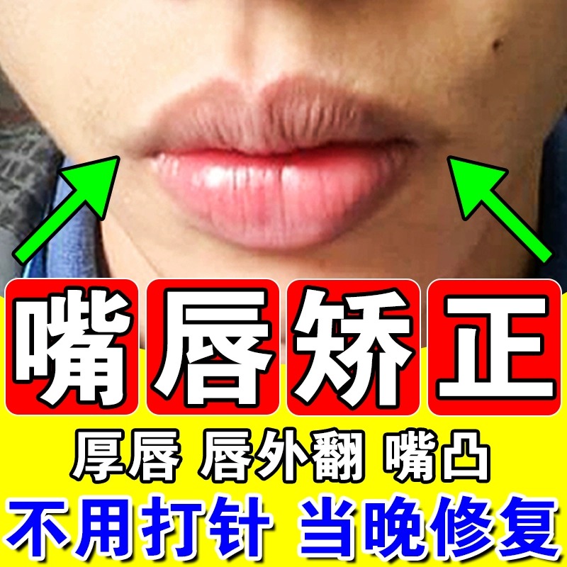 嘴唇变薄变小上嘴唇外翻矫正防嘴凸矫正神器儿童瘦唇膏改善嘴唇厚