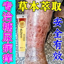 糖尿病皮肤痒专用治老年人血糖高皮肤瘙痒止痒膏干燥烂红斑抑菌