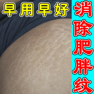 肥胖纹修复霜消除去肥胖纹大腿肥胖纹生长纹激素纹膨胀淡化疤痕药