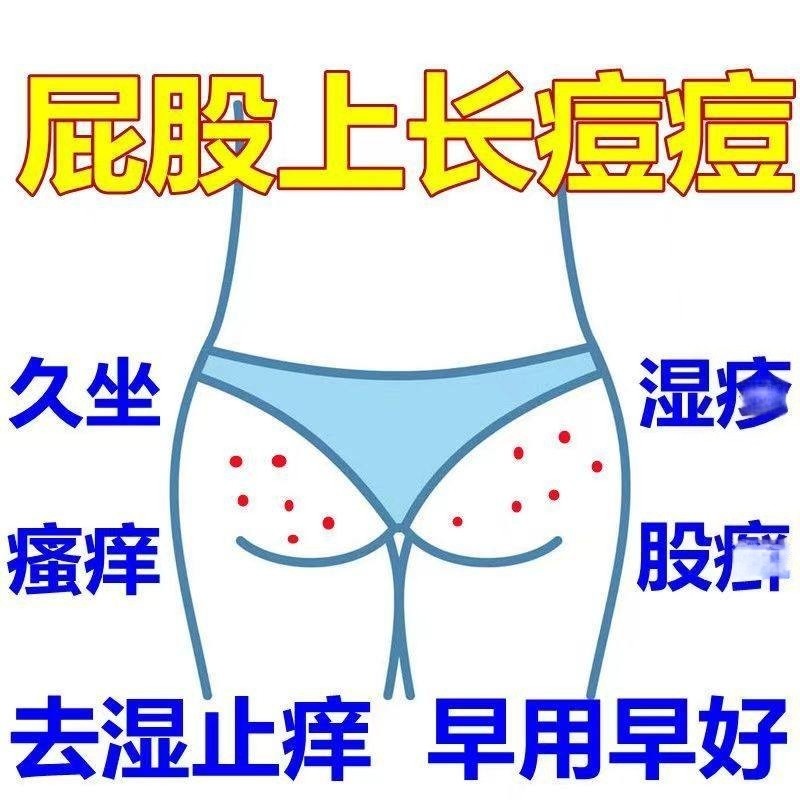 屁股痘痘长疙瘩坐板疮痛痒药大腿内侧红店长痘瘙痒过敏臀部湿毒膏