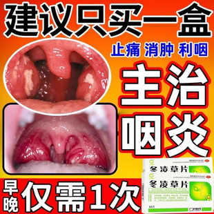 冬凌草片45片治咽喉炎慢性咽炎专用嗓子特除有异物效药卡痰根咽喉