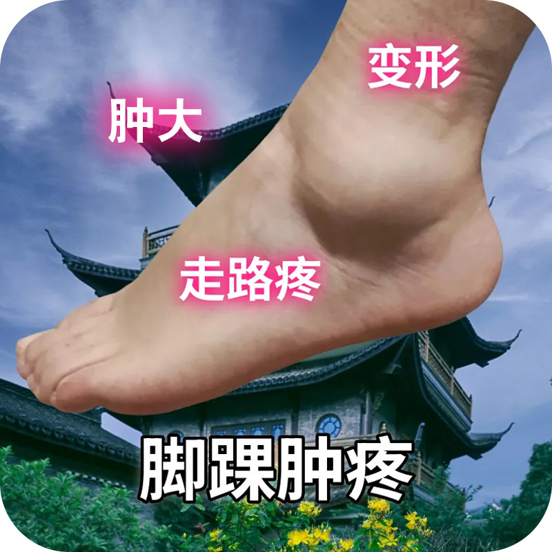 脚脖子疼痛脚腕肿胀踝关节疼消肿止痛麻木僵硬痛脚脖痛一动就疼s