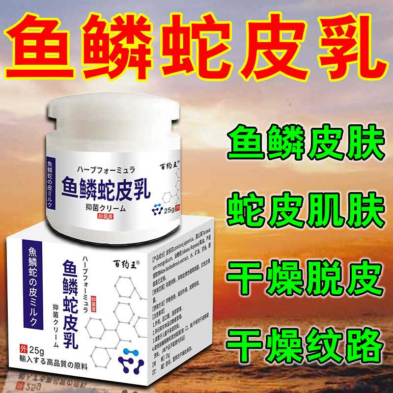 鱼鳞病皮肤霜专用膏去蛇皮肤鱼鳞腿部病皮肤干燥起皮脱屑保湿乳