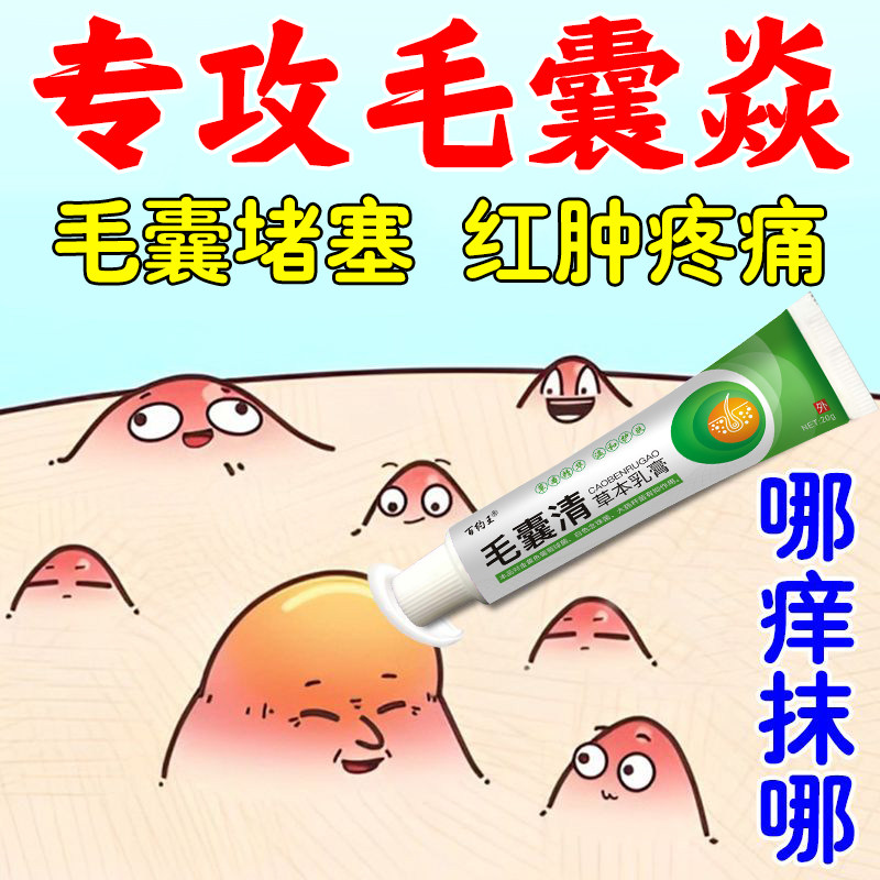 头皮毛囊焱专用膏头部脖子前胸后背私处长痘痘痒溢脂性毛囊藓乳膏