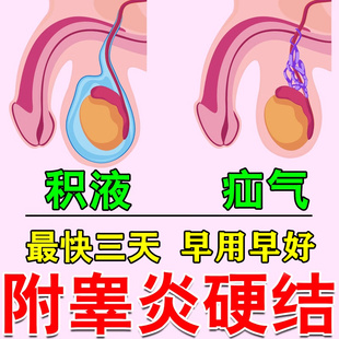 附睾炎硬结发炎疼痛鞘膜积液睾丸两个不一样大精索静脉曲张喷剂
