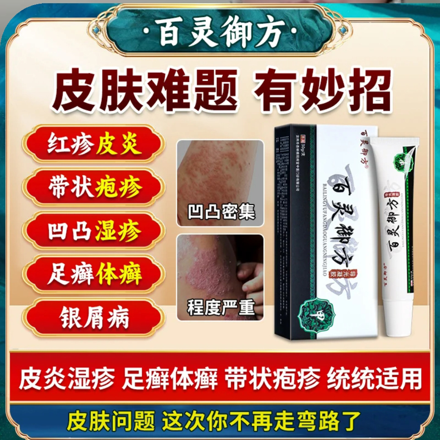 百灵御方导光凝胶皮肤红斑瘙痒皮炎红疹干燥脱屑皮肤凹凸敏感凝胶