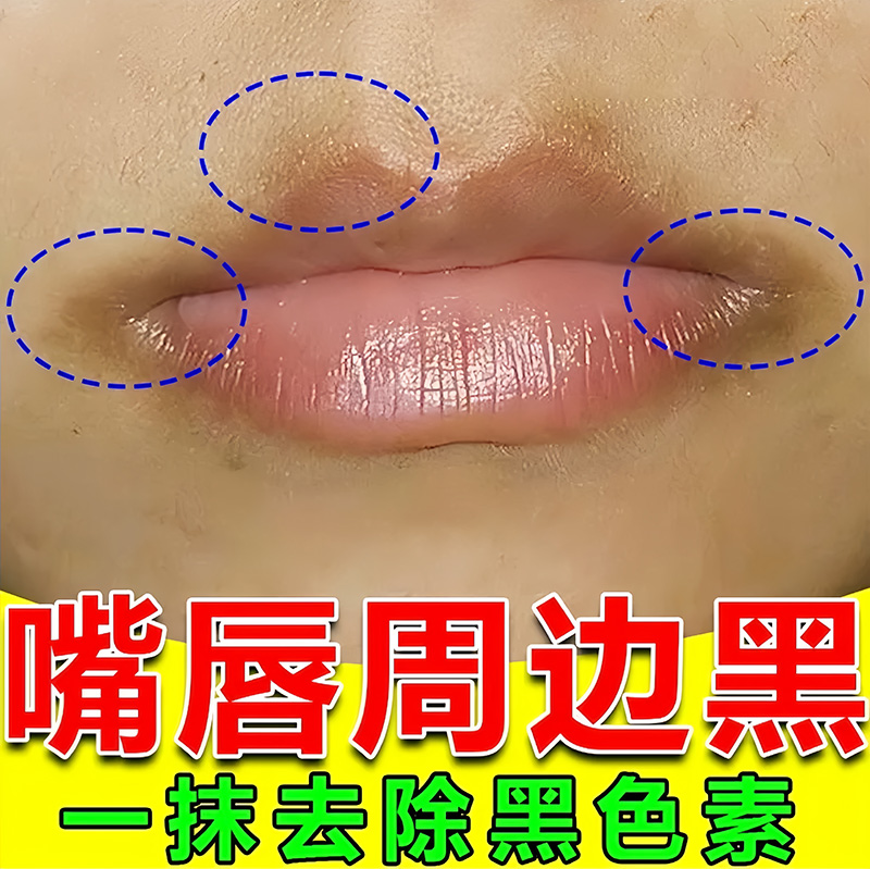 去除唇周黑改善嘴角暗沉嘴巴周边黑淡化唇纹唇色去黑色素专用唇膏