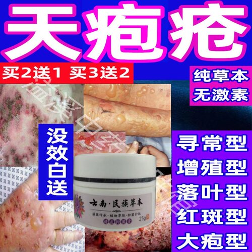天疱疮外用药寻常增殖落叶大疱红斑良型类天疱疮大疱表皮松解症膏