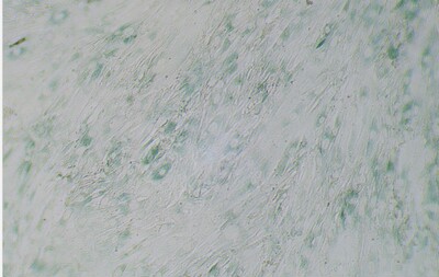 细胞衰老模型 细胞衰老 β-半乳糖苷酶细胞实验 病理实验技术服务