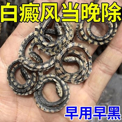 白癜风特效外用药膏快速消白斑专用补骨脂酊遮盖液黑色素生长RL