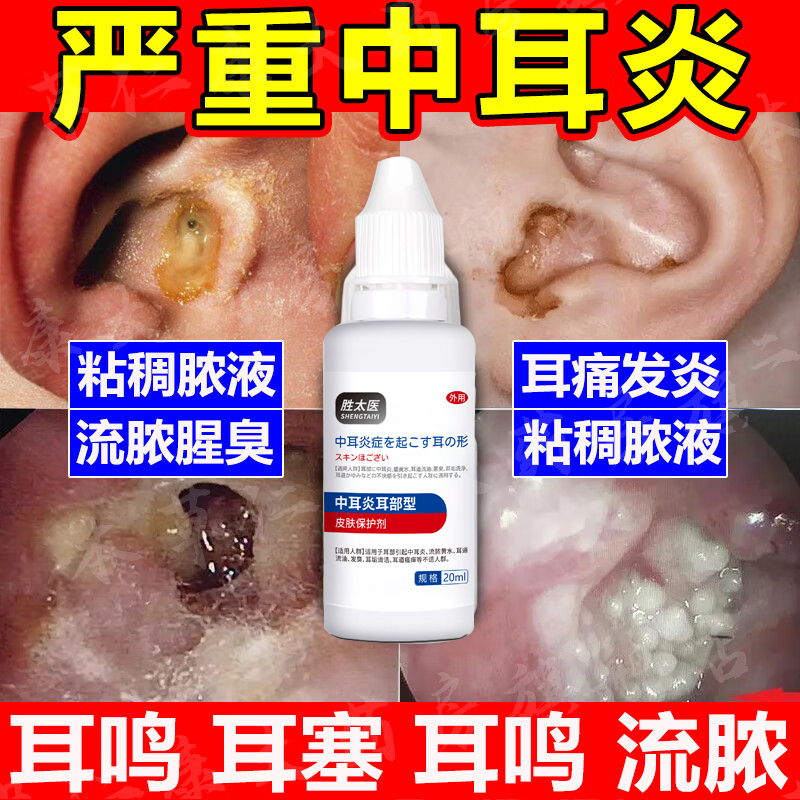 清热散结片正品MACAT麦科特片片