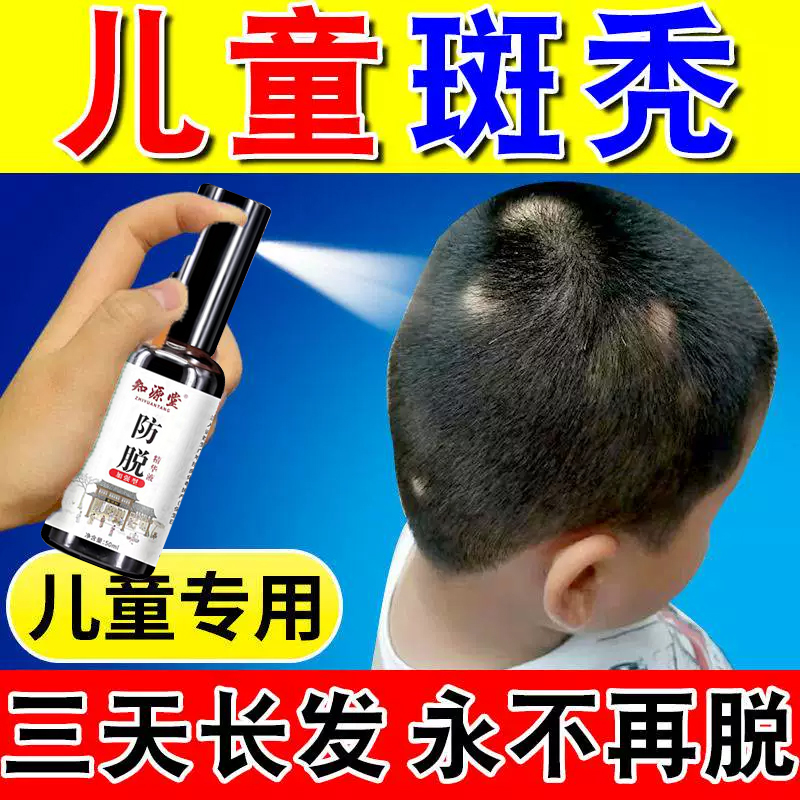 非那雄胺溶液片启悦男性脱发雄激素性脂溢性脱发口服药生发增发密