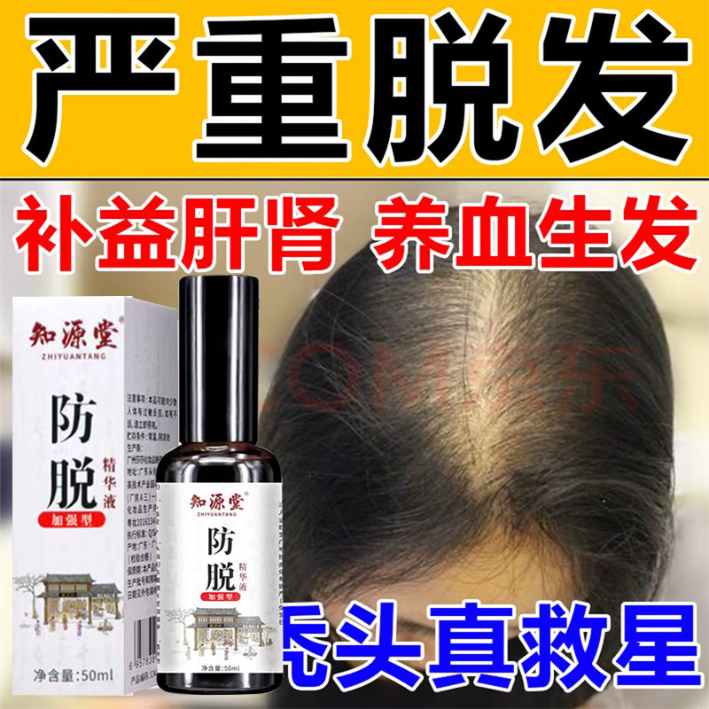 天麻首乌片国华白发治疗脱发白发严重男脂溢性脱发息风图片
