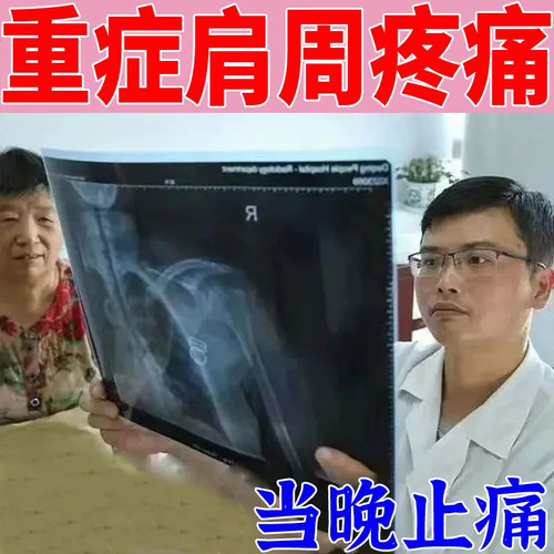 壮骨麝香止痛膏贴陪都麒麟膏膏片祛风湿关节扭伤