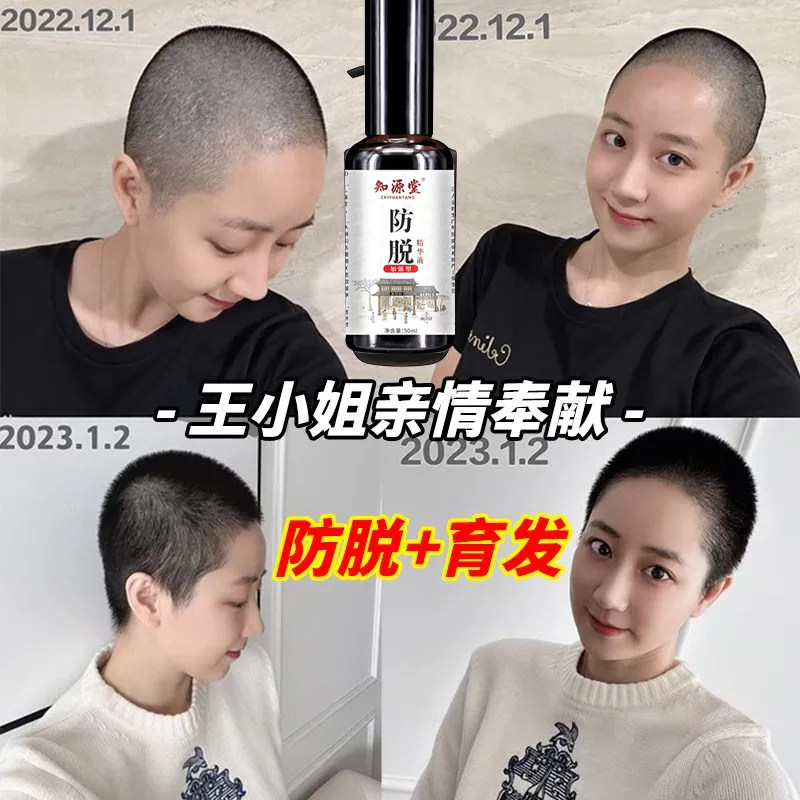 除脂生发片祺笑正品保证脂溢性脱发快速脱发白发图片