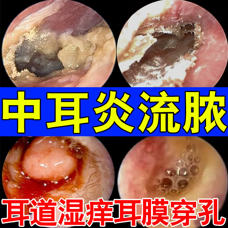 油耳朵滴耳液耳垢清洁液儿童清洁器宝宝滴耳洗耳屎软化剂喷雾神器