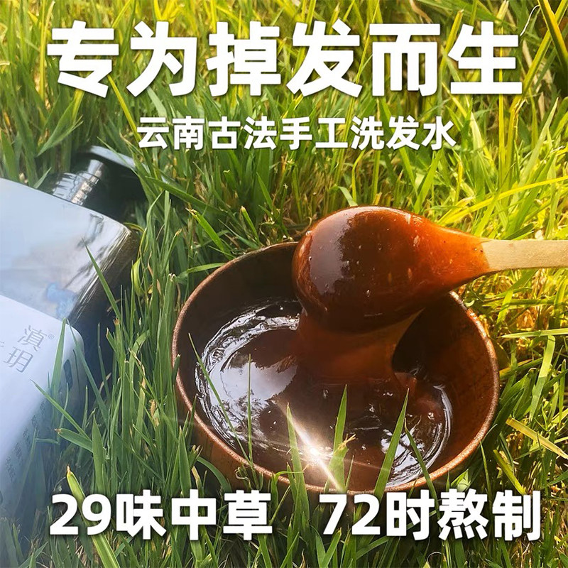 天麻首乌片国华白发治疗脱发白发严重男脂溢性脱发息风图片