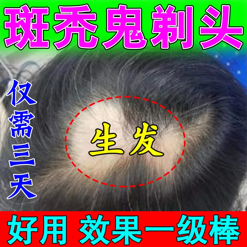 斑秃生发剂复方斯亚旦生发酊防脱发脂溢性脱发白发生发密发增发图片