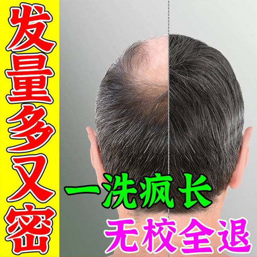 胱氨酸维生素 b6德国奥适宝护发养发头发族b6b7生物素营养