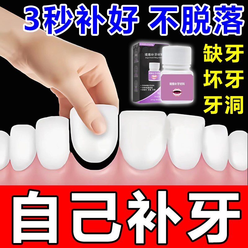补牙神器自填充材料己永久医用树脂在临时家牙洞假牙缝粘合剂瓷粉