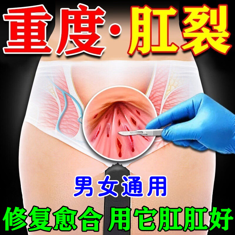 肛裂愈合膏肛门瘙痒开裂肛门干裂撕裂疼痛大便出血陈旧性裂口专用