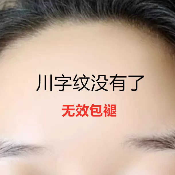 【屈臣氏热卖】水滴川字纹贴眉间纹神器皱眉心额头淡化悬针纹