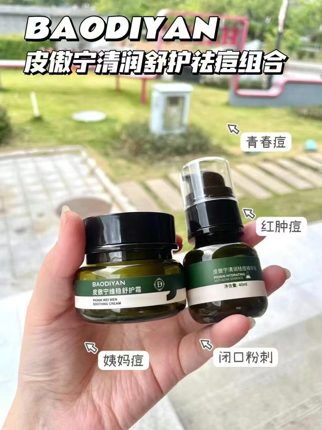 皮傲宁祛痘精华液+维稳舒护霜修复痘肌淡化痘印改善粉刺闭口修护