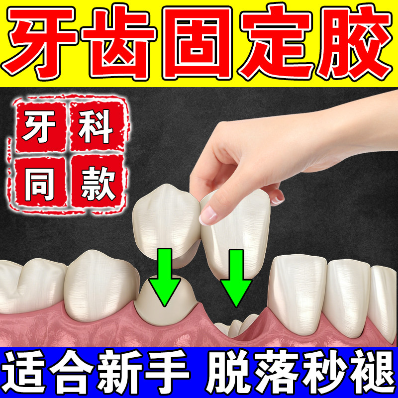 假牙粘合剂医用粘牙胶水牙齿松动固定烤瓷牙齿冠松动专用粘合接剂