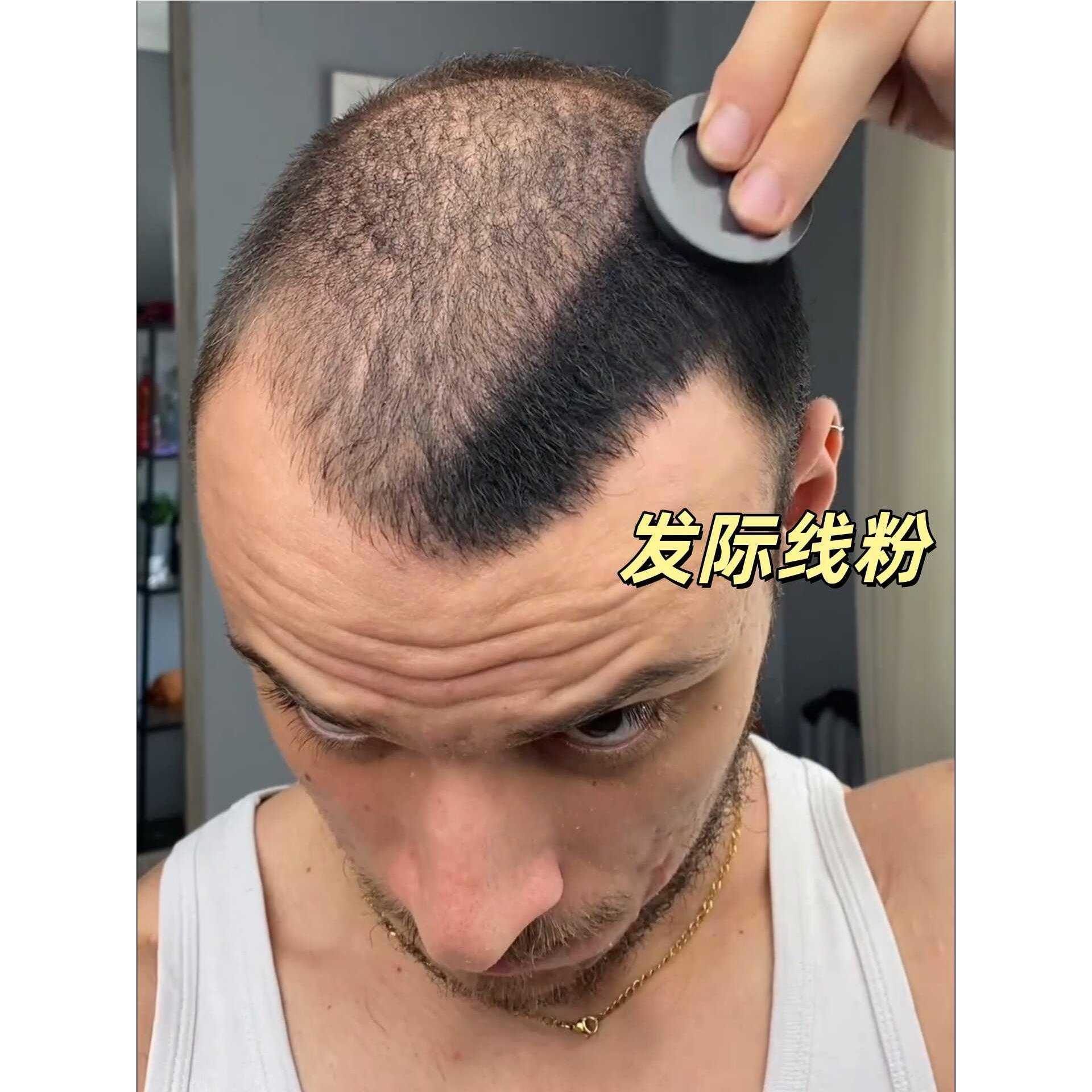 发际线遮盖粉防水防汗不伤头皮