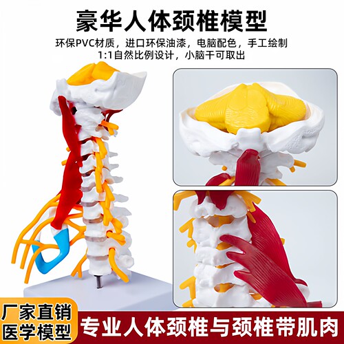 人体颈椎关节颈动脉后枕骨模型