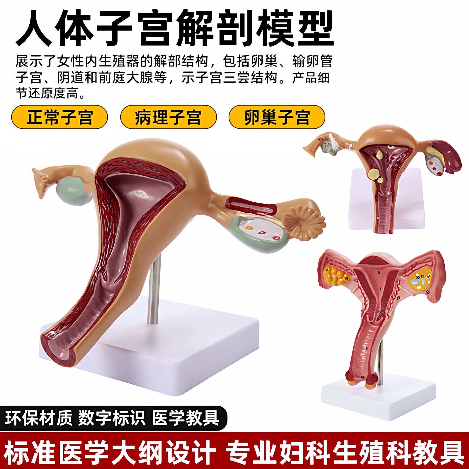 人体子宫卵巢附件女性生殖器阴道病理变结构解剖模型医学教学模具
