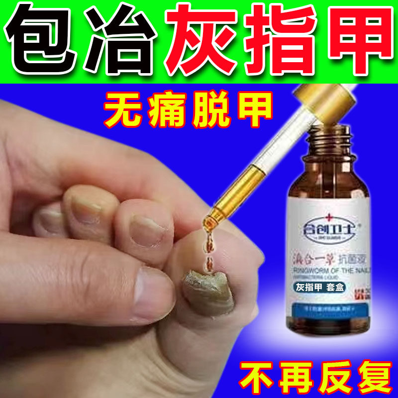 灰指甲抑菌液治疗手脚趾指甲变厚变黄亮甲药水