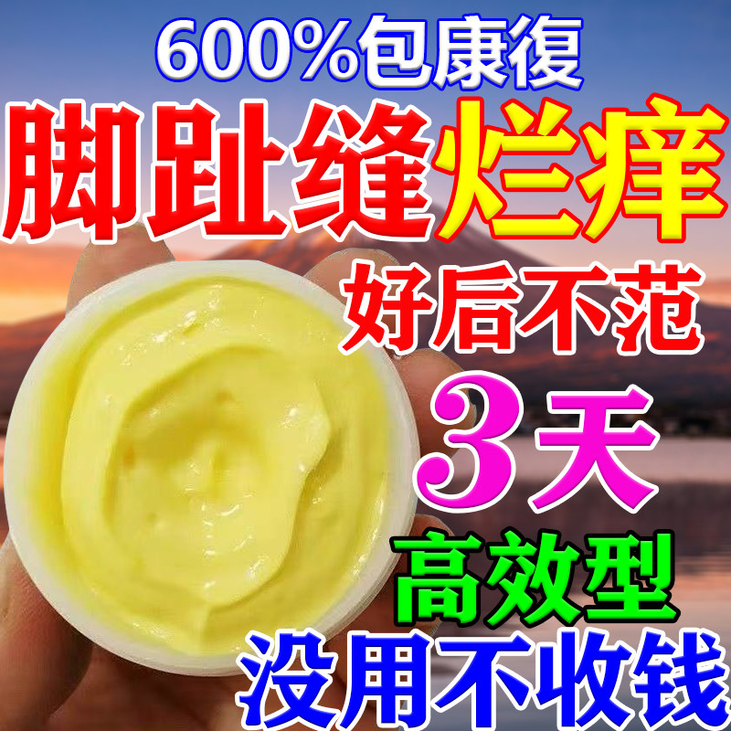 老偏方脚膏止痒气根去专用的药烂脚丫脱皮糜烂水泡脚趾缝真菌感染