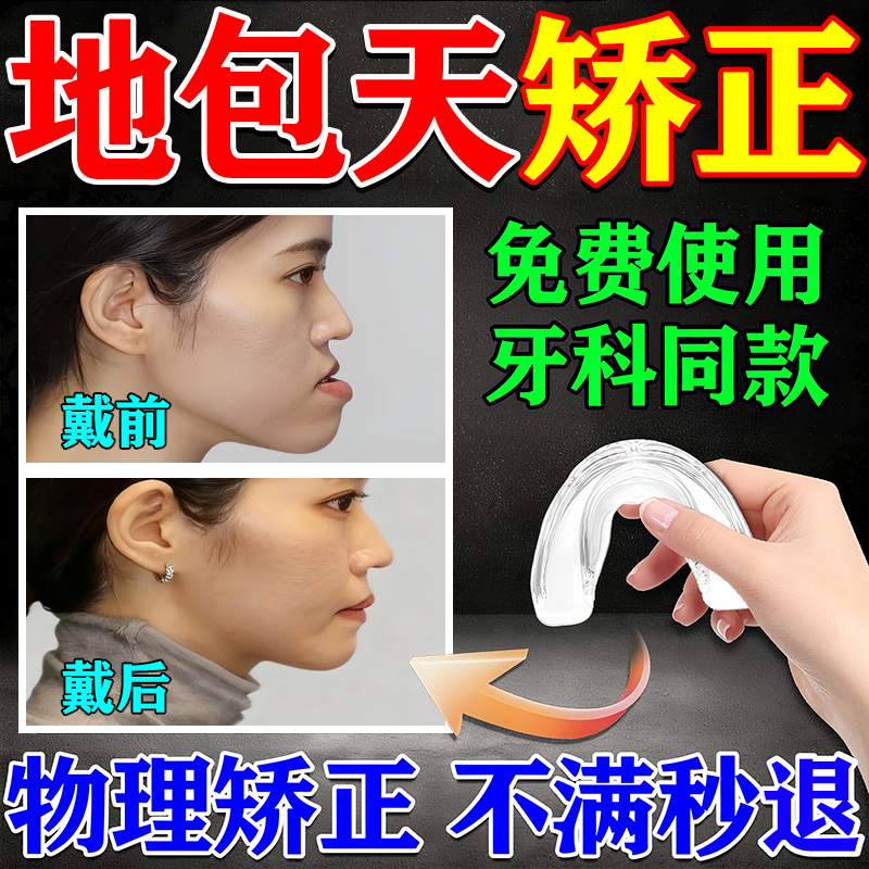 地包天矫正器儿童成人牵引神器纠正磨牙颞下颌关节紊乱正畸通用器