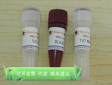 一步法TUNEL细胞凋亡检测试剂盒(绿色荧光) 碧云天生物 Beyotime