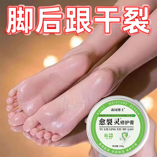 愈裂灵修护膏冬季脚后跟皲裂护手霜手足干裂粗糙皲裂防冻痒止滋润
