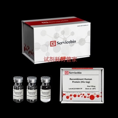 重组人CD4蛋白 His标记Recombinant Human CD4 Protein (His-tag)