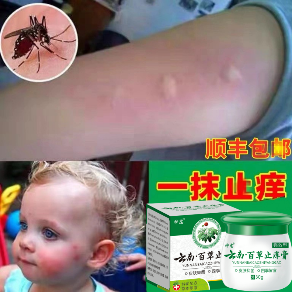 蚊虫叮咬跳蚤咬止痒消肿膏螨臭虫蚊子咬儿童成人皮肤过敏外用药膏
