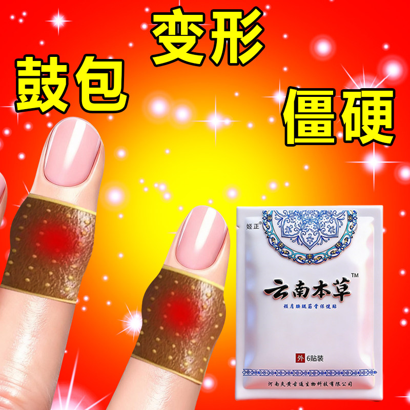 手足干裂脱皮贴腱鞘手指贴手指鼓包大拇指手指手足干裂手指